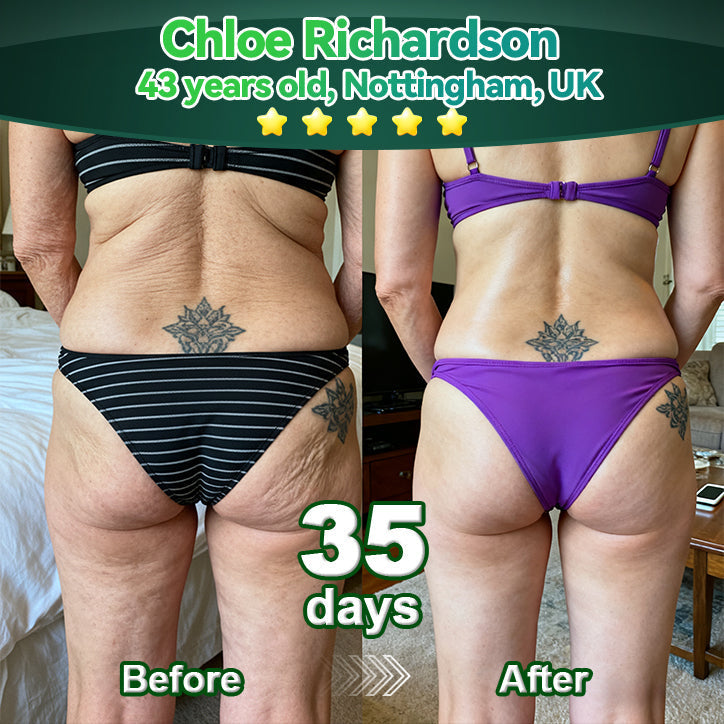 Lotmay® Oralne Kapi sa Matičnim Stanicama i Kolagenskim Peptidima 👩‍⚕️ (Podizanje i učvršćivanje opuštene kože te smanjenje nastanka bora) 🌿