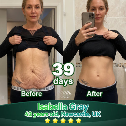 Lotmay® Oralne Kapi sa Matičnim Stanicama i Kolagenskim Peptidima 👩‍⚕️ (Podizanje i učvršćivanje opuštene kože te smanjenje nastanka bora) 🌿