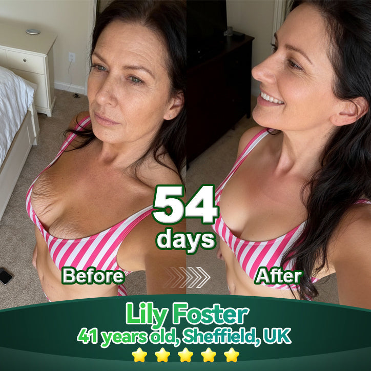 Lotmay® Oralne Kapi sa Matičnim Stanicama i Kolagenskim Peptidima 👩‍⚕️ (Podizanje i učvršćivanje opuštene kože te smanjenje nastanka bora) 🌿