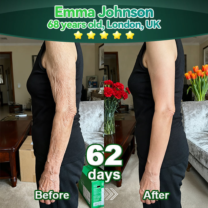 Lotmay® Oralne Kapi sa Matičnim Stanicama i Kolagenskim Peptidima 👩‍⚕️ (Podizanje i učvršćivanje opuštene kože te smanjenje nastanka bora) 🌿